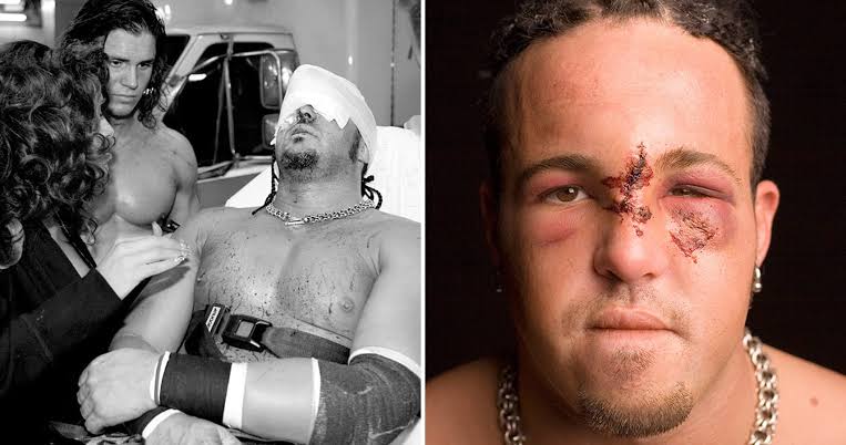 Joey Mercury – The Injury That Brokedown a Promising Career