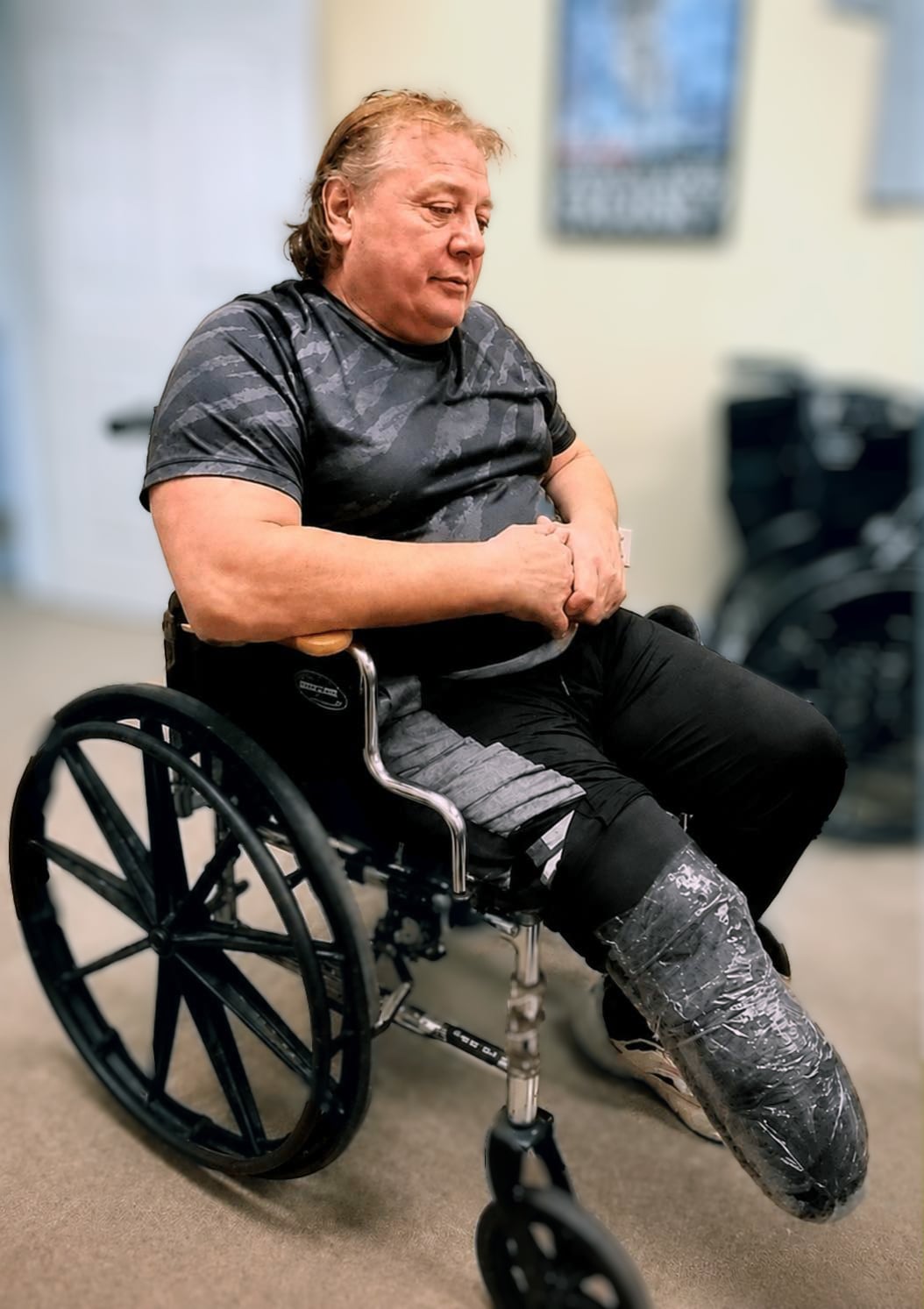 Marty Jannetty - His Turbulent Life After The Rockers Marty Jannetty, the former WWE Rockers tag team star, underwent a below-the-knee amputation on April 1, 2026, following a years-long battle with infection stemming from longstanding ankle injuries.