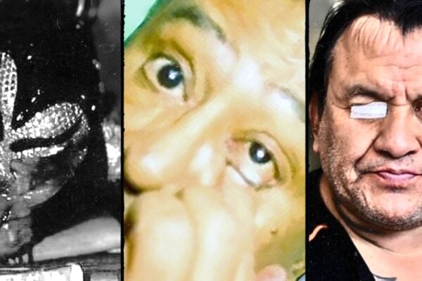 Blindsided: 4 Lucha Wrestlers Who Lost an Eye in a Match